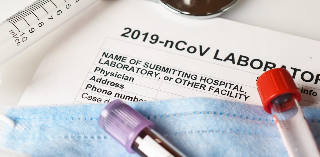 blog_post_4-min-p76lw82xyij9co5zoue40sczf8yqcim86mc2i6yi0w